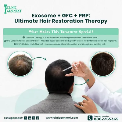 For maximum impact, I have developed an ultimate hair restoration therapy combining Exosome, GFC, and PRP. This powerful trio works together to regenerate follicles at a cellular level, provide concentrated growth factors for faster regrowth, and strengthen existing hair.