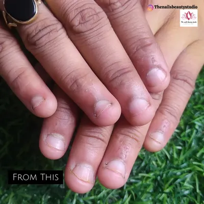 A truly special transformation for a bride-to-be who was a nail biter. I created this beautiful, short, milky-white extension set for her wedding day.
