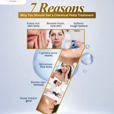 This infographic explains 7 key reasons to get a chemical peel. From evening out skin tone and lightening acne marks to revealing fresh, new skin, it's a versatile treatment for skin renewal.