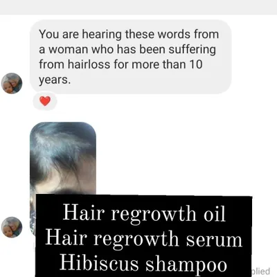 This message was so powerful to read. To help someone who has been suffering from hair loss for over 10 years is the reason I do what I do. She found relief with my hair regrowth oil, serum, and hibiscus shampoo.
