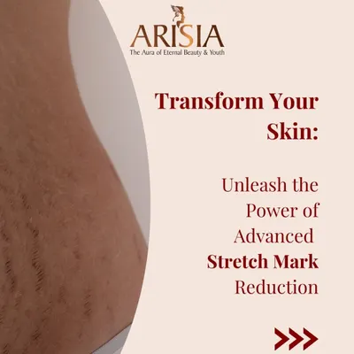 Don't let stretch marks affect your confidence. We use advanced treatments like Morpheus8 to effectively reduce their appearance and transform your skin.