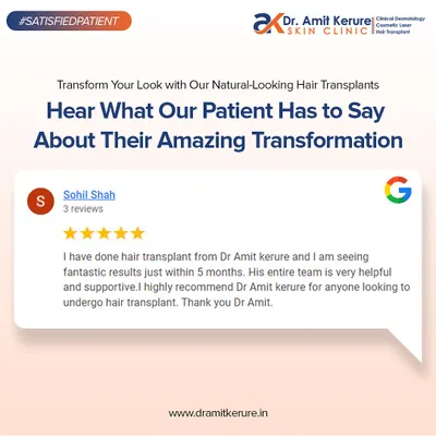 I am grateful for the trust my patients place in me. This review from a happy patient highlights the fantastic results seen within five months and the supportive experience provided by my entire team.