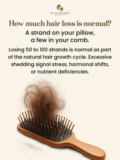 Losing 50 to 100 strands of hair per day is a normal part of the natural hair growth cycle. However, excessive shedding beyond this amount can signal an underlying issue that warrants a professional consultation to investigate potential triggers.