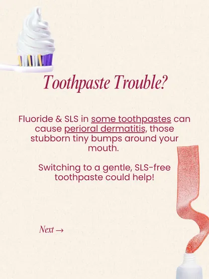 Are you experiencing toothpaste trouble? Fluoride and SLS in some toothpastes can cause perioral dermatitis, those tiny bumps around your mouth. Switching to a gentle, SLS-free toothpaste could be the solution.