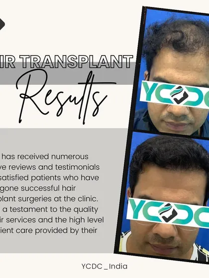 This graphic combines a powerful before-and-after result with a note on patient satisfaction, emphasizing the quality of care and successful outcomes at my clinic.
