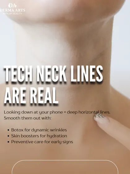 Tech neck lines are a real concern. This image explains how Botox and skin boosters can smooth the deep horizontal lines caused by looking down at phones.