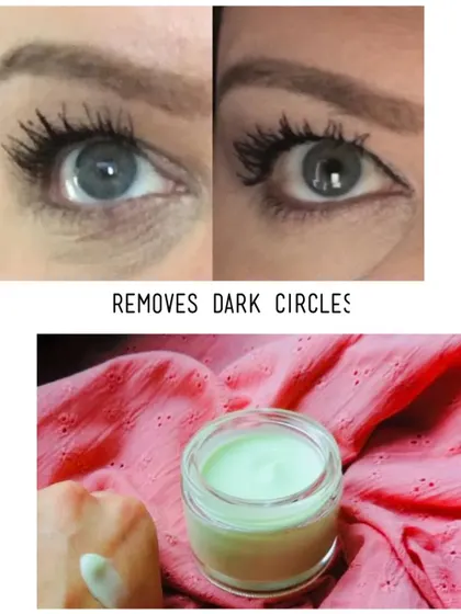 Dark circles can be tough, but my Magical Under Eye Cream is here to help. This before and after shows how it works to reduce puffiness and brighten the under-eye area.
