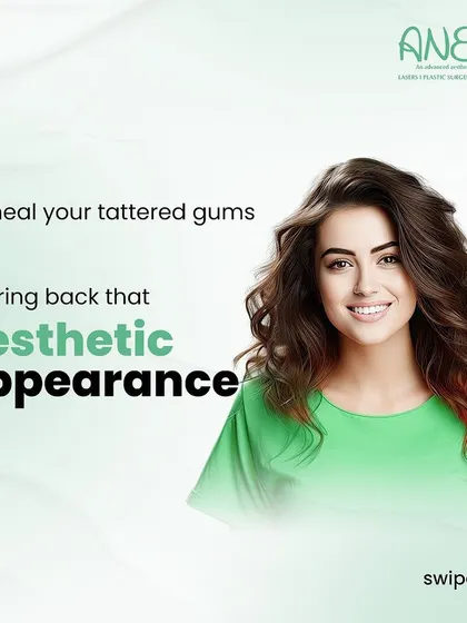 A healthy smile starts with healthy gums. This image represents my advanced laser gum treatments, which are designed to heal gums and restore their aesthetic appearance without the pain, bleeding, or stitches of traditional surgery.