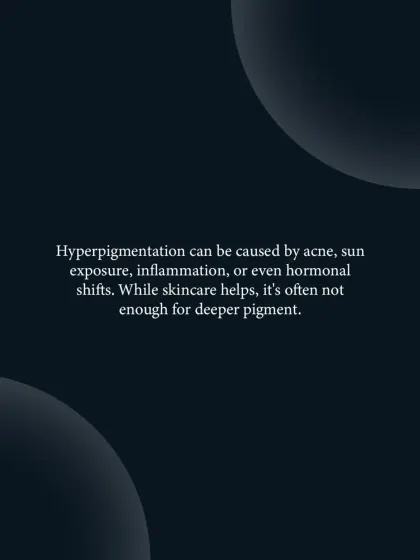 Hyperpigmentation has multiple triggers, including sun exposure, inflammation from acne, or hormonal shifts. While topical skincare can help, deeper or stubborn pigment often requires professional intervention.