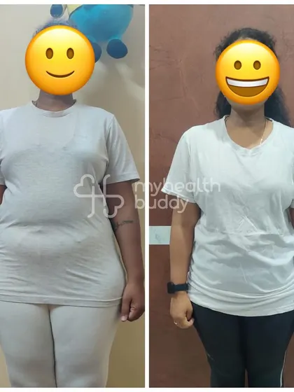 A front view of the same 6kg transformation. It shows that you don't need to follow an extreme plan to see real, visible progress.