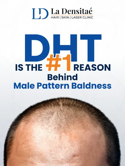 This post explains that DHT is the number one reason behind male pattern baldness. Understanding the cause is the first step to finding the right solution.