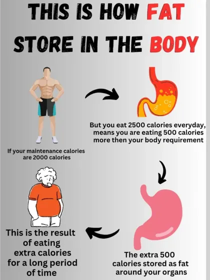 This is how fat is stored in the body. Eating extra calories over a long period leads to fat accumulation around your organs.