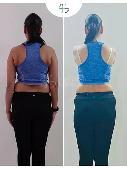 Back view showing a more toned and defined back. It's not just about weight loss, but about building a stronger body.