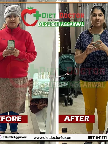 This new mother successfully lost 10 kgs in the 3 months following her delivery. My post-pregnancy diets are carefully crafted to ensure optimal nutrition for both the mother and the baby.