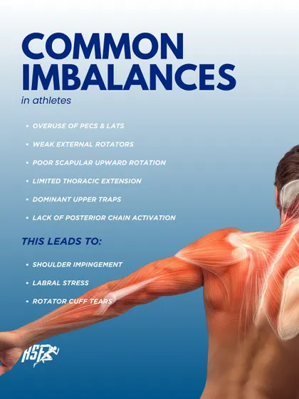 Common imbalances in athletes, like overuse of pecs and weak external rotators, lead to issues like shoulder impingement and rotator cuff tears. I address these imbalances to prevent injury.