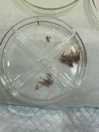 These are harvested hair follicles, known as grafts, being kept in a sterile, hydrated environment. They are sorted by the number of hairs per graft (1, 2, or 3) to be strategically placed for a natural-looking result.