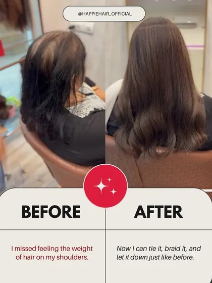 Many women miss the simple feeling of the weight of their hair on their shoulders. Our full-volume toppers and wigs bring back that familiar comfort, allowing you to tie, braid, or let your hair down.