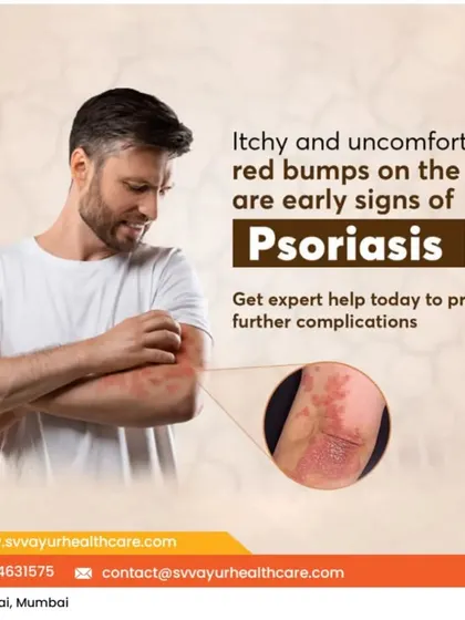 Psoriasis can be a persistent and uncomfortable condition, often appearing as itchy, red bumps. It is important to seek expert help to manage the symptoms and prevent complications. My Ayurvedic treatments focus on managing these flare-ups and addressing the internal triggers of psoriasis.