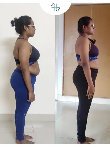 This client lost 7 kgs in 12 weeks. She learned to maintain her diet and workout consistently, without regrets or cravings.