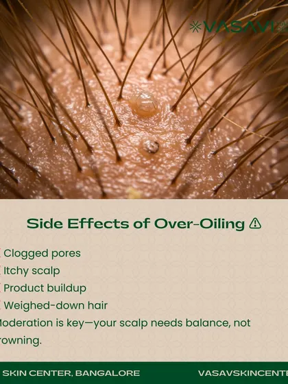Over-oiling the scalp can lead to several side effects, including clogged pores, an itchy scalp, product buildup, and weighed-down hair. Your scalp needs balance, and I advise my patients that moderation is essential for maintaining scalp health.