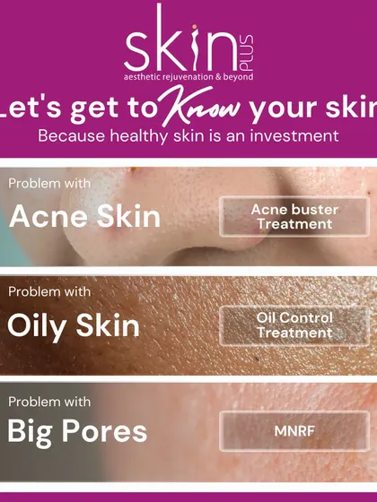 An image illustrating the common skin problems I address. It highlights my targeted solutions, including Acne Buster Treatment for acne, Oil Control Treatment for oily skin, and MNRF for large pores.