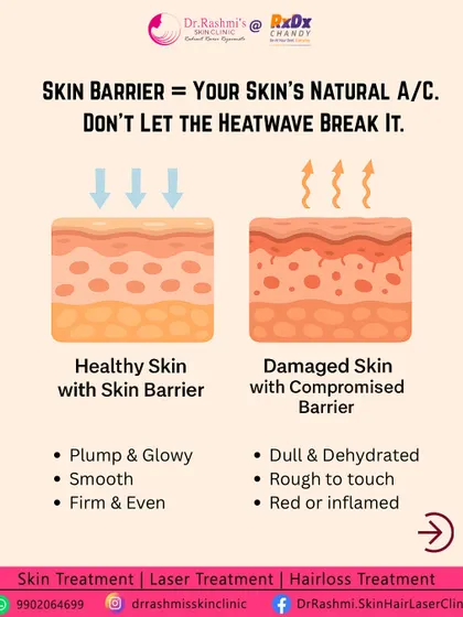 A healthy skin barrier is your skin's natural defense. This graphic shows how a damaged barrier can lead to dull, dehydrated, and inflamed skin, making it more susceptible to pigmentation and other issues.