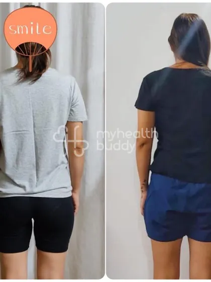 The back view also shows improved posture and a stronger core, which are key benefits of a proper postpartum recovery plan.