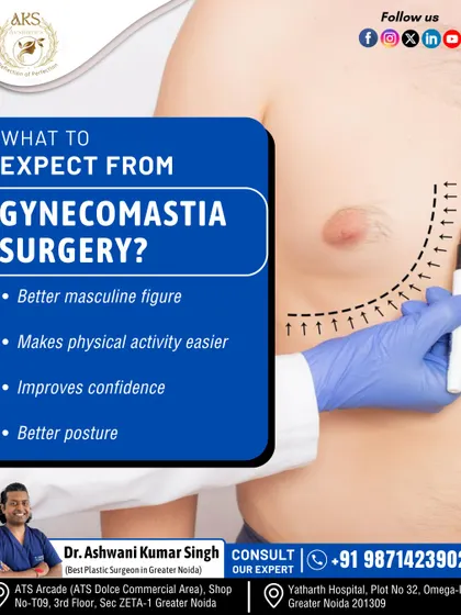 When considering gynecomastia surgery, it's important to know what to expect. The primary outcomes are a more masculine figure, improved confidence, better posture, and greater ease during physical activity.