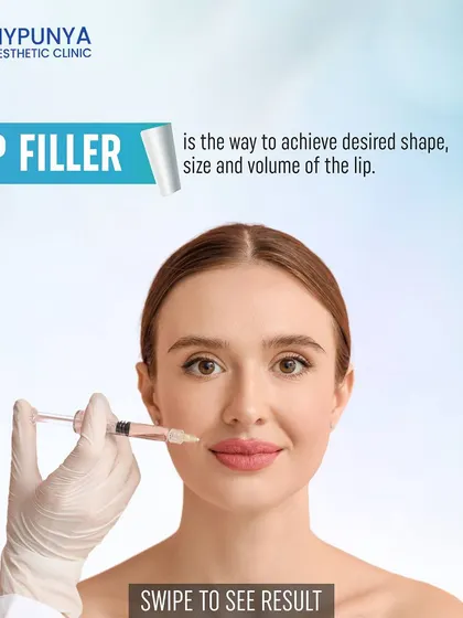Lip filler is the ideal treatment to achieve your desired lip shape, size, and volume. Using hyaluronic acid, we can artfully sculpt your lips.