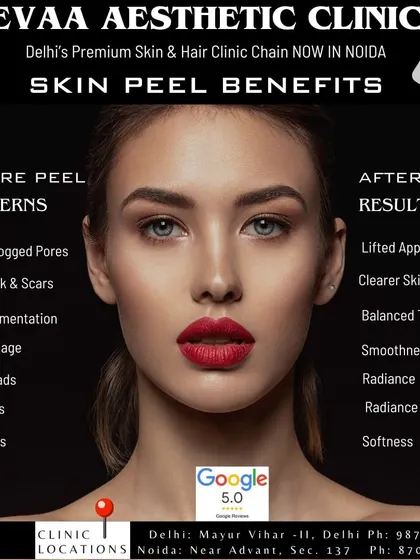 A comprehensive look at the concerns a skin peel can address (before) and the results you can expect (after), from clearer skin to improved radiance and softness.