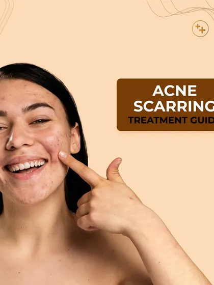 Our comprehensive treatment guide for acne scarring. Understanding your scars is the first step towards finding the most effective solution for your skin.