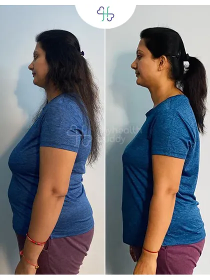 A side view of Rashmi's 15kg weight loss. She learned the importance of patience and consistency through our simple diet and home workout plan.