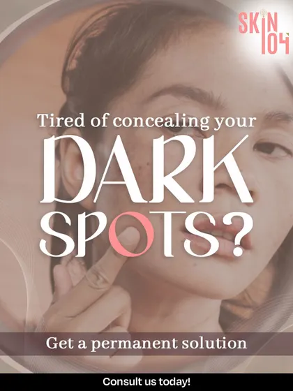 Tired of concealing your dark spots every day? We offer permanent solutions that treat the root cause of pigmentation, so you can stop covering up and let your natural, clear skin shine through.