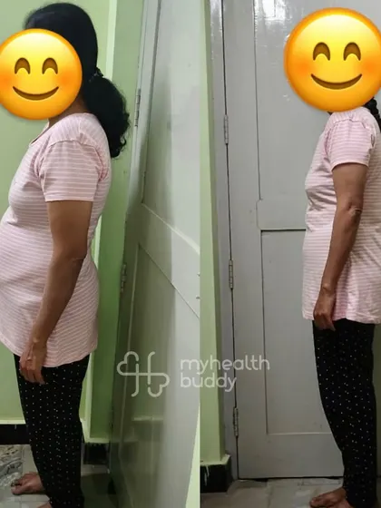 Side view of her progress. Her improved posture and confidence shine through.