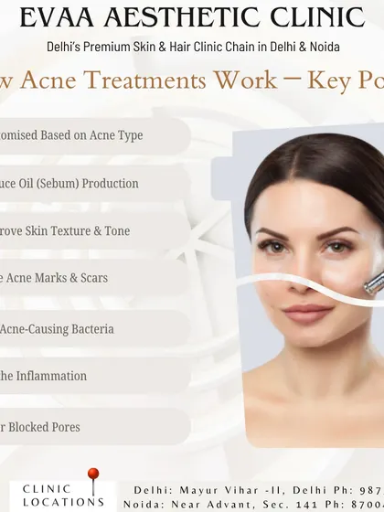 A breakdown of how our acne treatments work, focusing on key actions like reducing sebum production, fading acne marks, killing bacteria, and clearing blocked pores.