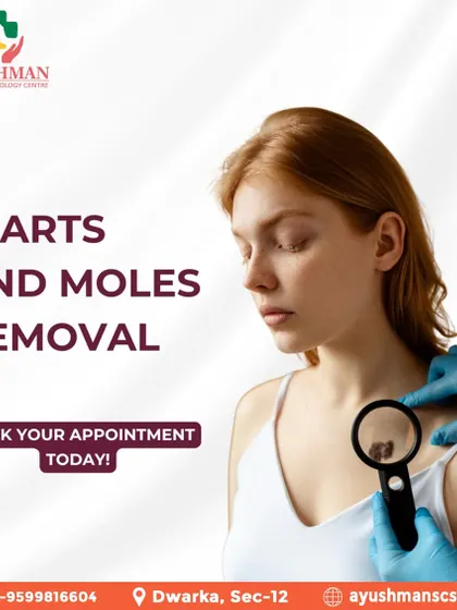 Say goodbye to unwanted warts and moles with my professional removal services. Book an appointment for a safe and effective treatment to achieve clearer skin.