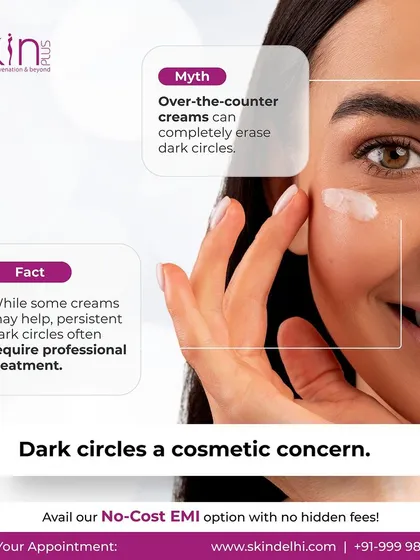 A myth-busting graphic about dark circles. It clarifies that while some over-the-counter creams may help, persistent dark circles often require professional treatment for effective results.