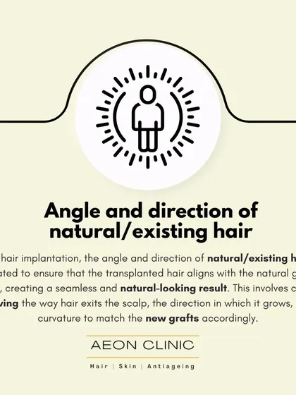 We carefully evaluate the angle and direction of your existing hair to ensure the transplanted hair aligns with the natural growth pattern, creating a seamless result.