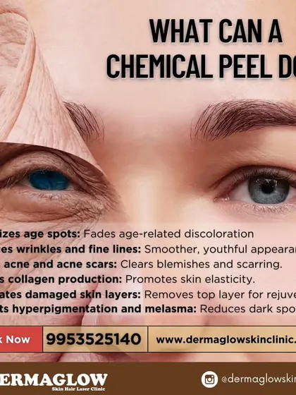 A chemical peel is a versatile treatment that addresses multiple skin concerns at once. This visual explains how the procedure works to minimize age spots, reduce fine lines, treat acne and scarring, and boost collagen. It is a powerful tool for comprehensive skin rejuvenation.