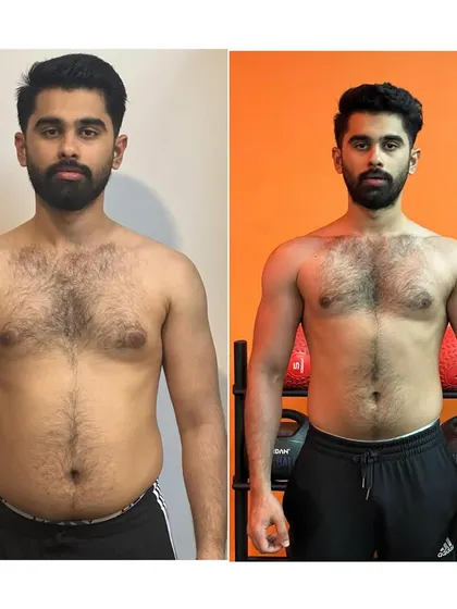 This front-view comparison highlights a successful body recomposition. We focused on reducing body fat while building lean muscle in the shoulders and chest for a more athletic physique.