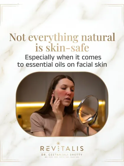 Not Everything Natural is Skin-Safe, Especially Essential Oils. This carousel opener debunks the myth that "natural" equals "safe." I often see patients with burns and breakouts from using undiluted essential oils on their faces.