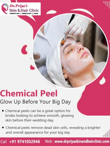 For brides seeking smooth, glowing skin before their wedding day, chemical peels are an excellent option. The treatment removes dead skin cells, revealing a brighter complexion perfect for the big day.