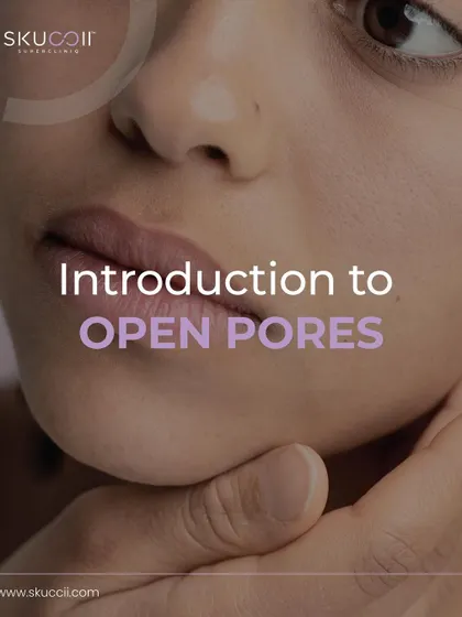 An introduction to open pores, a common skin concern. This is the first in a series explaining the causes of open pores and the effective, medical-grade treatments we offer to minimize their appearance and improve overall skin texture.