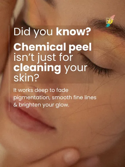 A chemical peel is much more than a surface-level cleaning. It works deep within the skin to fade pigmentation, smooth fine lines, and brighten your overall glow by stimulating cellular turnover.