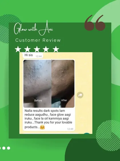 A picture is worth a thousand words. This before and after from a happy customer shows how my products helped reduce dark spots and control oiliness. This is the kind of change that makes me so happy.