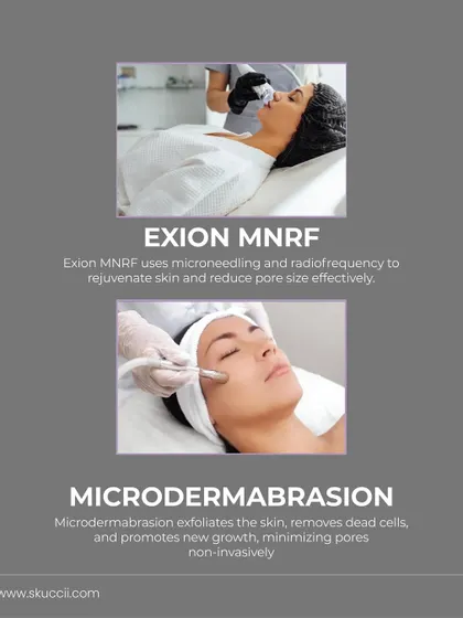This graphic highlights two powerful treatments for reducing pore size: Exion MNRF, which uses microneedling and radiofrequency, and Microdermabrasion, a non-invasive exfoliation method that removes dead cells and promotes new growth.