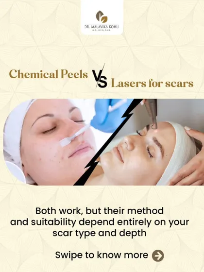 Chemical peels versus lasers for scars: which is right for you? This post explains that while both work, their suitability depends entirely on your scar type and depth, as they target different layers of the skin.