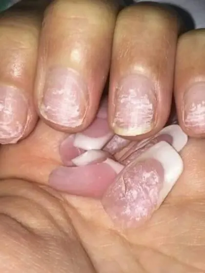 A visual reminder that extensions don't ruin your nails, but improperly picking or tearing them off does.