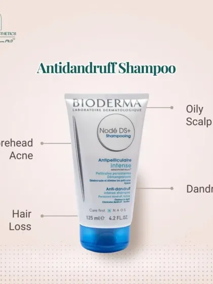 An anti-dandruff shampoo can do more than treat your scalp. It can also help with forehead acne and hair loss associated with scalp inflammation.
