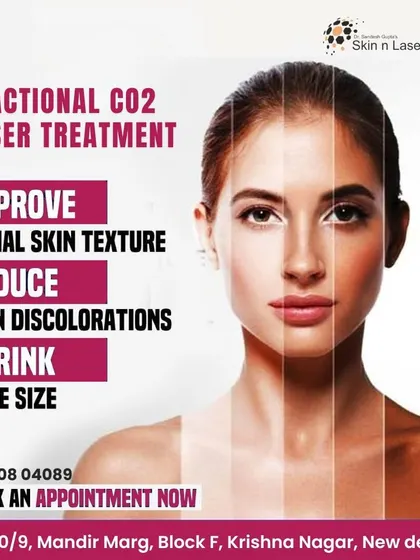 A Fractional CO2 laser treatment can improve facial skin texture, reduce skin discolorations, and shrink pore size. This graphic shows how the treatment can transform your skin.